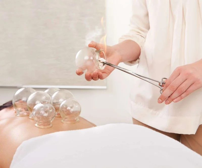Cupping equipment and cups positioned on the back